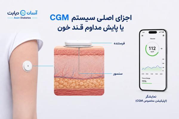 راهنمای خرید و مقایسه سنسورهای قند خون در ایران؛ مزایا، معایب و نکات کلیدی نصب