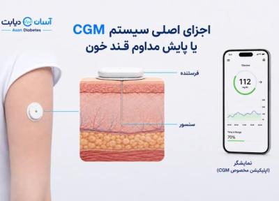 راهنمای خرید و مقایسه سنسورهای قند خون در ایران؛ مزایا، معایب و نکات کلیدی نصب راهنمای خرید و مقایسه سنسورهای قند خون در ایران؛ مزایا، معایب و نکات کلیدی نصب